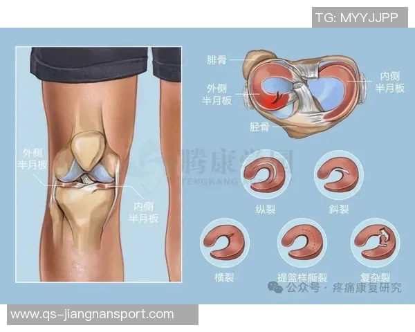 加比亚左膝过度伸展受伤情况更新已排除韧带和半月板损伤风险 加比亚左膝过度伸展受伤情况更新已排除韧带和半月板损伤风险